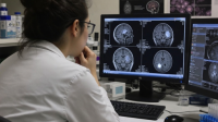 Brain-Cancer-Vitamin Brain Cancer Vitamin